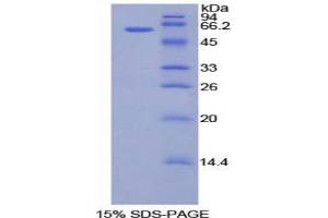 SDS-PAGE analysis of Human CILP Protein.