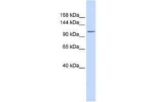 ATP2B3 antibody used at 1 ug/ml to detect target protein.