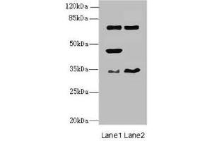 Western blot All lanes: EHF antibody at 4. (EHF Antikörper  (AA 1-210))