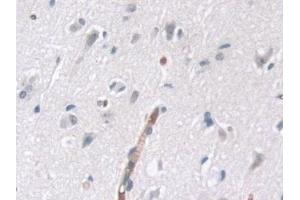 Detection of tPK1 in Human Cerebrum Tissue using Polyclonal Antibody to Tau-Protein Kinase 1 (tPK1) (TPK1 Antikörper  (AA 34-300))