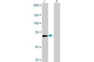 Western Blot analysis of SLC9A6 expression in transfected 293T cell line by SLC9A6 monoclonal antibody (M02), clone 2D5.