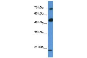 Western Blotting (WB) image for anti-rho GTPase Activating Protein 36 (ARHGAP36) (N-Term) antibody (ABIN406257) (ARHGAP36 Antikörper  (N-Term))