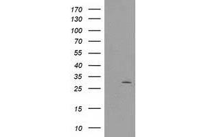 Image no. 3 for anti-CTD (Carboxy-terminal Domain, RNA Polymerase II, Polypeptide A) Small Phosphatase 1 (CTDSP1) antibody (ABIN1497678)