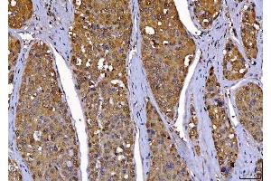 IHC analysis of Cdk2 using anti-Cdk2 antibody (ABIN7602523).