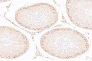 Immunohistochemistry analysis of paraffin-embedded rat testis using,IFNL3 (ABIN7074356) at dilution of 1: 2000 (IL28B Antikörper)