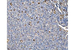 IHC analysis of Glycogen synthase 1/GYS1 using anti-Glycogen synthase 1/GYS1 antibody (ABIN7602155).