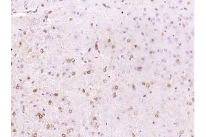 Immunohistochemistry (Paraffin-embedded Sections) (IHC (p)) image for anti-Amyloid beta (A4) Precursor Protein-Binding, Family A, Member 1 (APBA1) (AA 451-550) antibody (ABIN1386516)