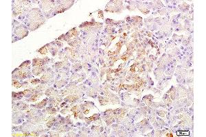 Formalin-fixed and paraffin embedded rat pancreas labeled with Anti-SDF-1/CXCL12 Polyclonal Antibody, Unconjugated (ABIN1386329) at 1:200 followed by conjugation to the secondary antibody and DAB staining (CXCL12 Antikörper  (AA 24-70))