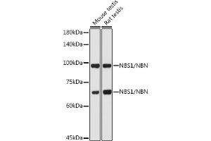 Western blot analysis of extracts of various cell lines, using NBS1/NBS1/NBN antibody (ABIN1681204, ABIN3015326, ABIN3015327 and ABIN5663771) at 1:1000 dilution. (Nibrin Antikörper  (AA 435-754))