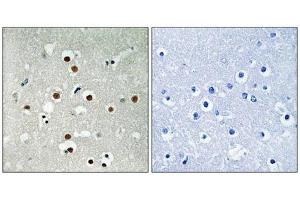 Immunohistochemical analysis of paraffin-embedded human brain tissue using MEF2C (Phospho-Ser396) antibody (left)or the same antibody preincubated with blocking peptide (right). (MEF2C Antikörper  (pSer396))