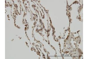 Immunoperoxidase of monoclonal antibody to NFKBIB on formalin-fixed paraffin-embedded human lung. (NFKBIB Antikörper  (AA 56-145))