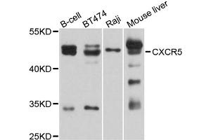 Western blot analysis of extracts of various cell lines, using CXCR5 antibody (ABIN5995664) at 1/1000 dilution. (CXCR5 Antikörper)