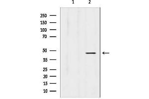 anti-L-2-Hydroxyglutarate Dehydrogenase (L2HGDH) (Internal Region) antibody