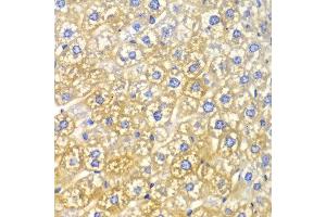 Immunohistochemistry of paraffin-embedded mouse liver using FASN antibody at dilution of 1:100 (400x lens). (Fatty Acid Synthase Antikörper)