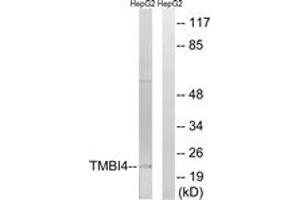 Western blot analysis of extracts from HepG2 cells, using TMBIM4 Antibody. (TMBIM4 Antikörper  (AA 121-170))