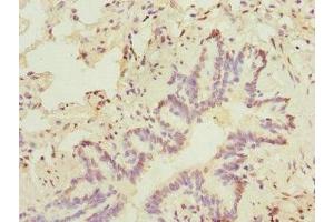 Immunohistochemistry of paraffin-embedded human lung tissue using ABIN7172635 at dilution of 1:100 (SOX5 Antikörper  (AA 1-120))