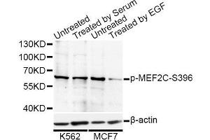 Western blot analysis of extracts of K-562 and MCF-7 cells, using Phospho-MEF2C-S396 antibody (ABIN5969920) at 1/1000 dilution. (MEF2C Antikörper  (pSer396))