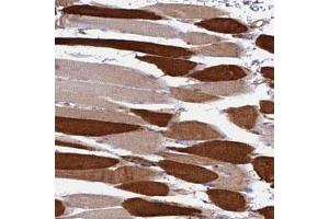 Immunohistochemical staining of human skeletal muscle with LOC653192 polyclonal antibody  shows strong cytoplasmic positivity in myocytes at 1:50-1:200 dilution. (TRIM43 Antikörper)