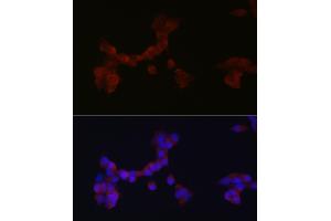 Immunofluorescence analysis of SH-SY5Y cells using D Rabbit pAb (ABIN6130320, ABIN6139385, ABIN6139386 and ABIN6214572) at dilution of 1:250 (40x lens). (DAB1 Antikörper  (AA 1-185))