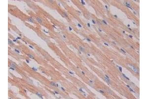 Detection of SIGIRR in Rat Heart Tissue using Polyclonal Antibody to Single Ig IL1 Related Receptor (SIGIRR) (SIGIRR Antikörper  (AA 1-118))