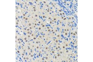 Immunohistochemistry of paraffin-embedded rat ovary using PIM1 antibody (ABIN7269375) at dilution of 1:100 (40x lens). (PIM1 Antikörper)