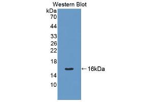 Western blot analysis of the recombinant protein. (Cytokeratin 7 Antikörper  (AA 394-457))