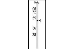 Western blot analysis of ADH6 Antibody in Hela cell line lysates (35ug/lane) (ADH6 Antikörper  (AA 209-240))