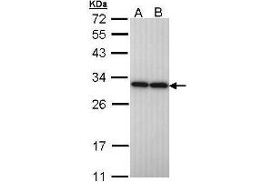 WB Image Sample (30 ug of whole cell lysate) A: H1299 B: Hela 12% SDS PAGE antibody diluted at 1:10000 (PGAM2 Antikörper)