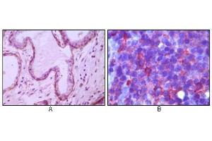 Immunohistochemical analysis of paraffin-embedded human breast ductal myoepithelium (A) and lymph tissue (B), showing cytoplasmic (A) and membrane (B) localization using CD10 antibody with DAB staining (A) and AEC staining (B).