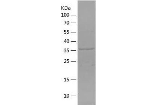 AGO1 Protein (AA 705-857) (His-IF2DI Tag)