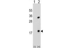 Western Blotting (WB) image for anti-Phospholipase A2, Group IB (PLA2G1B) antibody (ABIN3002154) (PLA2G1B Antikörper)