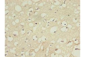 Immunohistochemistry of paraffin-embedded human brain tissue using ABIN7156983 at dilution of 1:100 (RABL4 Antikörper  (AA 1-186))