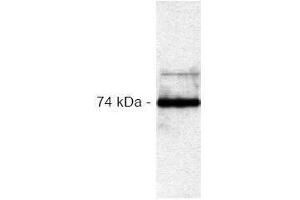 Western Blotting (WB) image for anti-V-Raf-1 Murine Leukemia Viral Oncogene Homolog 1 (RAF1) antibody (ABIN126882) (RAF1 Antikörper)