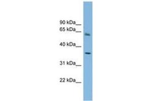 Image no. 1 for anti-Peroxisomal Biogenesis Factor 26 (PEX26) (AA 179-228) antibody (ABIN6744112) (PEX26 Antikörper  (AA 179-228))