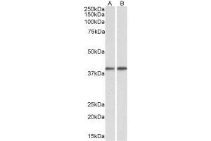 AP23750PU-N GNAQ antibody staining of Mouse (A) and Rat (B) Testis lysate at 0. (GNAQ Antikörper  (Internal Region))