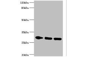 Western blot All lanes: PRKAB2 antibody at 5 μg/mL Lane 1: Rat brain tissue Lane 2: Mouse heart tissue Lane 3: Mouse gonad tissue Secondary Goat polyclonal to rabbit IgG at 1/10000 dilution Predicted band size: 31, 22 kDa Observed band size: 31 kDa (PRKAB2 Antikörper  (AA 1-272))
