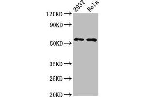 Western Blot Positive WB detected in: 293T whole cell lysate, Hela whole cell lysate All lanes: EPOR antibody at 4. (EPOR Antikörper  (AA 320-506))
