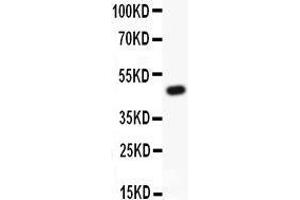 Western Blotting (WB) image for anti-Potassium Voltage-Gated Channel, Shab-Related Subfamily, Member 1 (KCNB1) (AA 687-858) antibody (ABIN3043866)