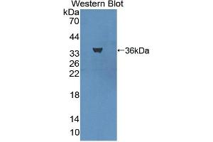 Western blot analysis of the recombinant protein. (LY75/DEC-205 Antikörper  (AA 216-503))