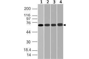 Image no. 1 for anti-DEAD (Asp-Glu-Ala-Asp) Box Polypeptide 3, X-Linked (DDX3X) (AA 10-230) antibody (ABIN5027138) (DDX3X Antikörper  (AA 10-230))