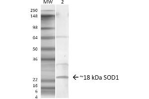 Western blot analysis of Mouse Lung showing detection of ~18 kDa SOD1 (EDI) protein using Rabbit Anti-SOD1 (EDI) Polyclonal Antibody . (SOD1 Antikörper  (C-Term) (PerCP))