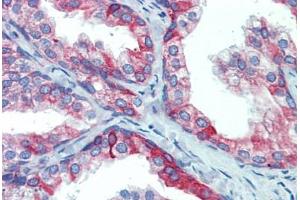 Prostate, Human: Formalin-Fixed, Paraffin-Embedded (FFPE) (PDIA4 Antikörper  (AA 623-638))