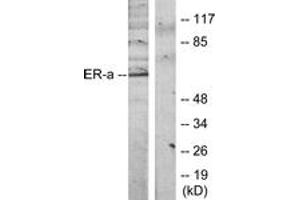 Western blot analysis of extracts from MCF7 cells, treated with Estradiol, using Estrogen Receptor-alpha (Ab-118) Antibody. (Estrogen Receptor alpha Antikörper  (AA 91-140))