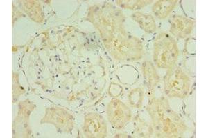Immunohistochemistry of paraffin-embedded human kidney tissue using ABIN7170959 at dilution of 1:100 (SULT1C2 Antikörper  (AA 1-120))