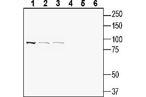 Western blot analysis of rat brain membranes (lanes 1 and 4), mouse Neuro-2a neuroblastoma cell line lysate (lanes 2 and 5) and human SH-SY5Y neuroblastoma cell line lysate (lanes 3 and 6): 1-3.