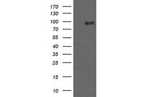 Image no. 2 for anti-Phosphoinositide-3-Kinase, Regulatory Subunit 5 (PIK3R5) antibody (ABIN1500214)