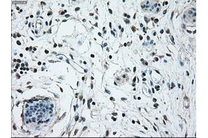 Immunohistochemical staining of paraffin-embedded breast tissue using anti-NRBP1 mouse monoclonal antibody. (NRBP1 Antikörper)