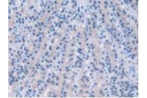 IHC-P analysis of Rat Stomach Tissue, with DAB staining. (PPP2R4 Antikörper  (Regulatory Subunit 4))