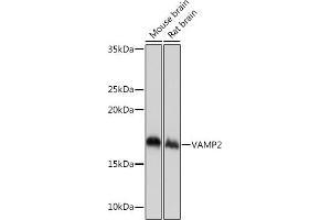 Western blot analysis of extracts of various cell lines, using V Rabbit mAb (ABIN7271313) at 1:1000 dilution. (VAMP2 Antikörper)