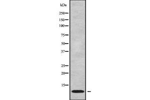 Western blot analysis NDUFC1 using Jurkat whole cell lysates (NDUFC1 Antikörper  (C-Term))